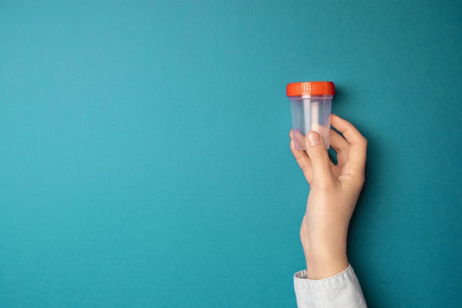 Doctor hand holds plastic container with tests on blue background
